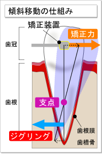 structure4