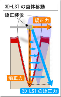 structure5